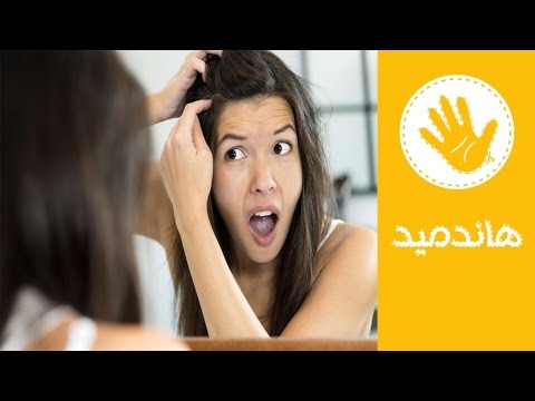 طرق طبيعيَّة وفعالة لعلاج قشرة الرأس