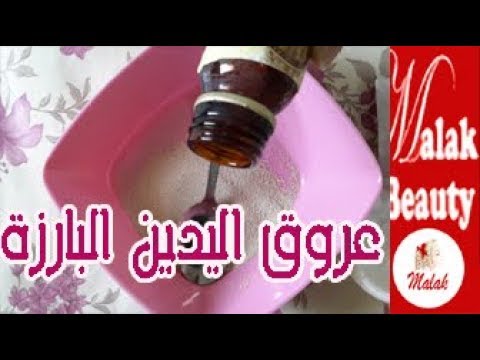 كيف تتخلصي نهائيًا من عروق اليدين