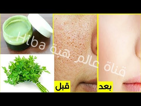 حزمة بقدونس تخلصك من المسام الواسعة