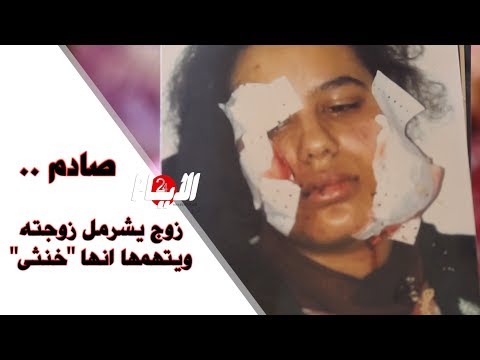 شاهد  رجل يعتدي على زوجته ويصفها بالخنثى