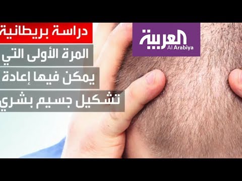 شاهد دراسة بريطانية تكتشف مادة كيميائية تواجه تساقط الشعر