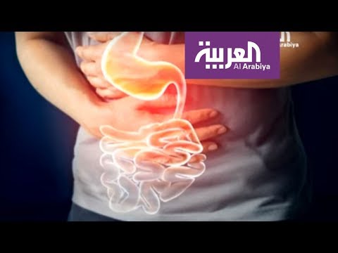 شاهد أسباب وأعراض وأحدث الطرق لعلاج قرحة المعدة