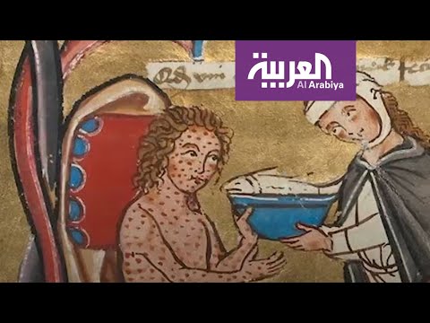 شاهد مرض مرعب ضرب العالم أشد من كورونا