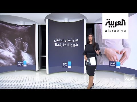 شاهد دراسة تكشف حقيقة انتقال كورونا من الأم الحامل إلى الجنين